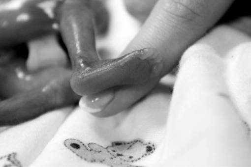  hand  black and white  ring  finger  arm  — black and white photo